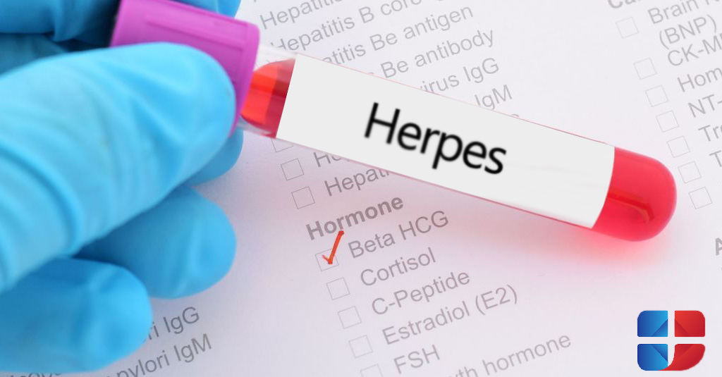 How is genital herpes treated?
