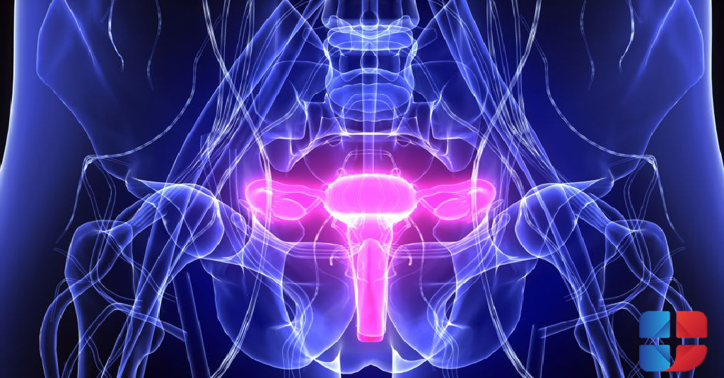 Pelvic inflammatory disease and infertility – what’s the connection?