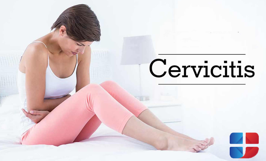 Cervicitis – inflammation of the cervix